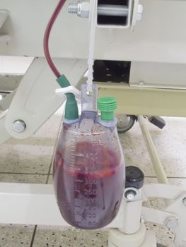 Blood from wound knee replacement surgery flow into bottle