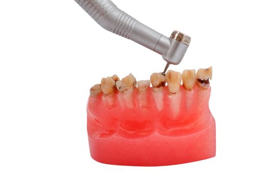jaw affected tooth decay and dental handpiece 