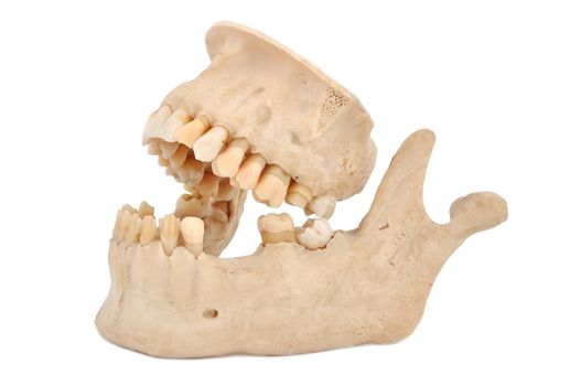 model of human teeth on a white background