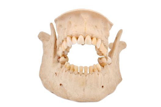 model of human teeth on a white background