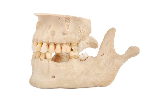 model of human teeth on a white background