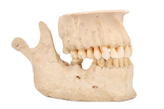 human jaw on a white background