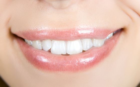 Smiling woman mouth with white teeth closeup
