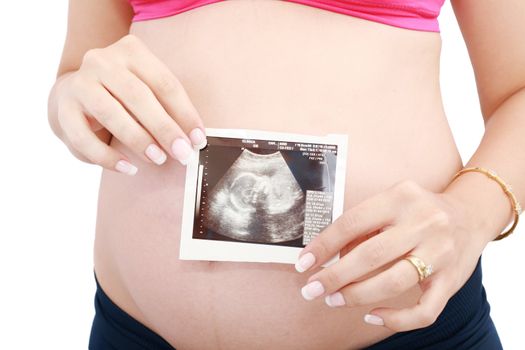 Pregnant woman's belly and ultrasound over white background.