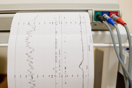 Cardiogram Ekg heart pulse results on the paper