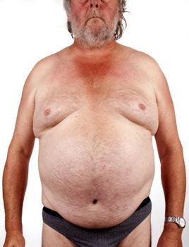 Elderly male body  with obesitas