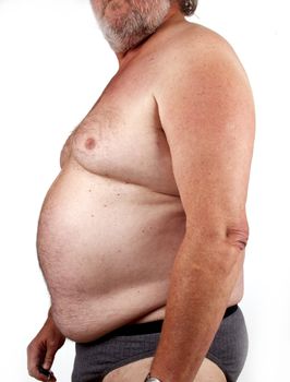 Elderly male body  with obesitas
