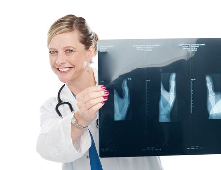 Female surgeon holding x-ray report of a patient and showing it to camera