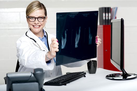 Experienced female physician holding x-ray report wearing glasses