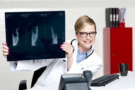 Medical surgeon expert holding x-ray report and showing it to camera