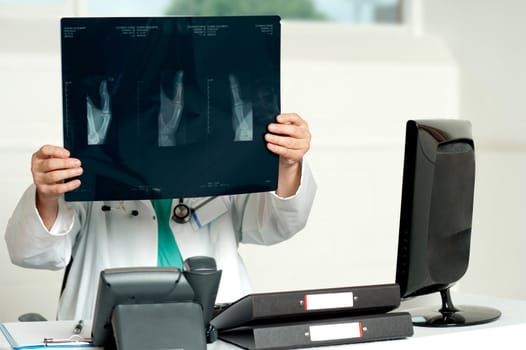 Male surgeon holding x-ray which hid his face