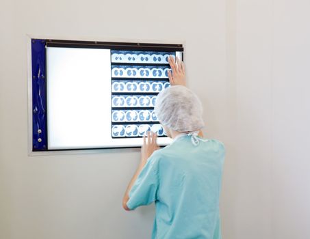 Female doctor examining an X-Ray image of patient