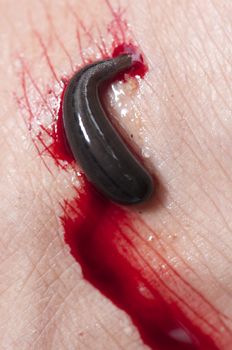 leech sucking blood from human