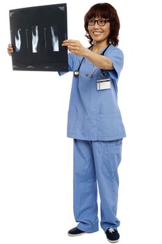 Full length portrait of asian nurse holding x-ray report of patient