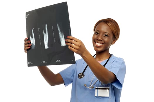 Experienced surgeon reviewing x-ray report, holding it up