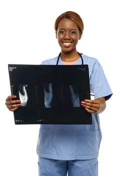 Medical expert holding patients x-ray report isolated over white background