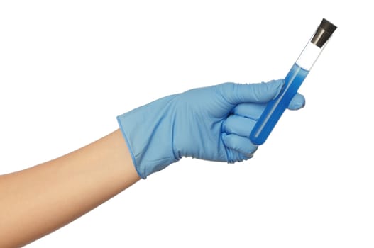 doctor holds a tube with sample of new antidote