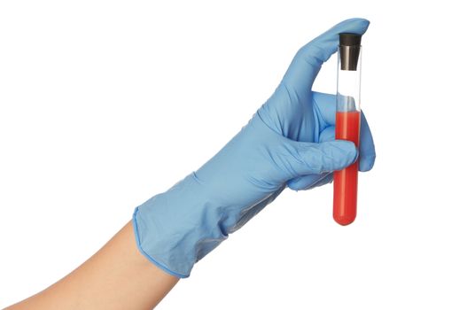 Doctor research a sample of blood for vaccine