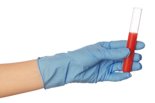 Doctor in blue gloves will be carry out research a samples of bloods at inhabitants of coast on availability of poisoning