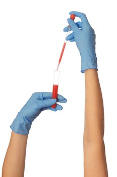 Doctor in blue gloves will be carry out research a samples of bloods at inhabitants of coast on availability of poisoning