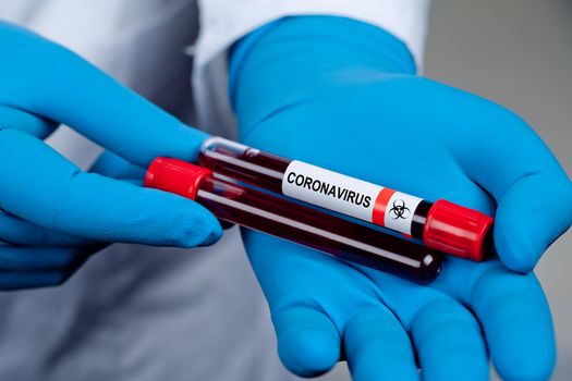 Corona virus outbreaking. Epidemic virus Respiratory Syndrome.