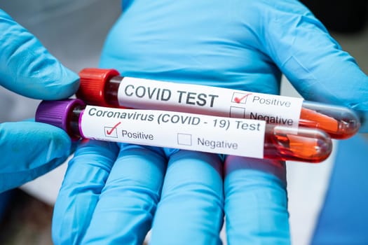 Positive blood infection sample in test tube for covid-19 coronavirus in lab. Scientist holding to check and analyze for patient in hospital.