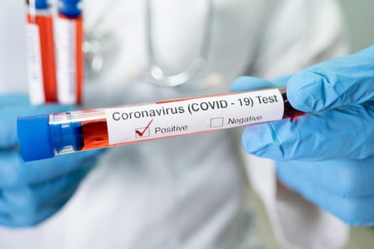 Positive blood infection sample in test tube for covid-19 coronavirus in lab. Scientist holding to check and analyze for patient in hospital.