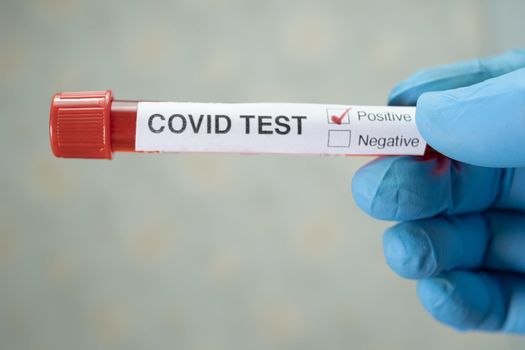 Positive blood infection sample in test tube for covid-19 coronavirus in lab. Scientist holding to check and analyze for patient in hospital.