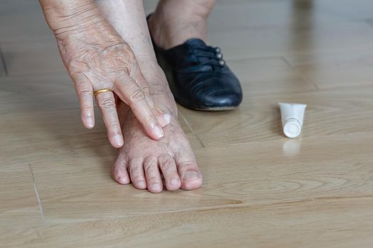Elderly woman putting cream on swollen feet before put on shoes