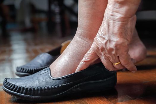 Elderly woman swollen feet putting on shoes