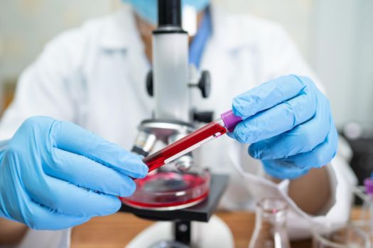 Scientist holding and analysis tube of micro biological sample outbreak Coronavirus or Covid-19 infectious in laboratory for doctor in the world.