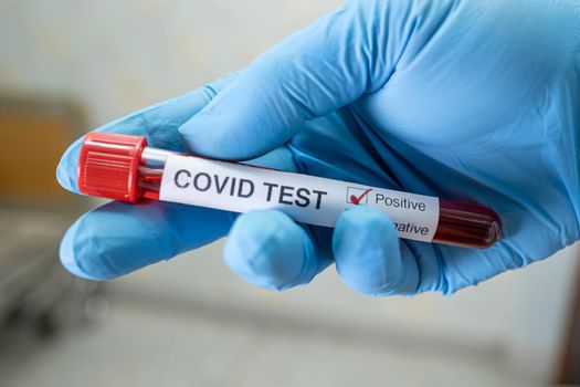 Positive blood infection sample in test tube for covid-19 coronavirus in lab. Scientist holding to check and analyze for patient in hospital.