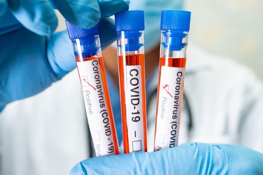 Positive blood infection sample in test tube for covid-19 coronavirus in lab. Scientist holding to check and analyze for patient in hospital.