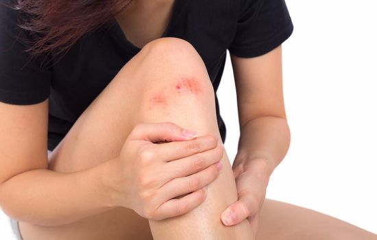 Woman with knee feeling pain on white background