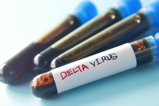 close up of delta corona virus blood test tube on blue background ,