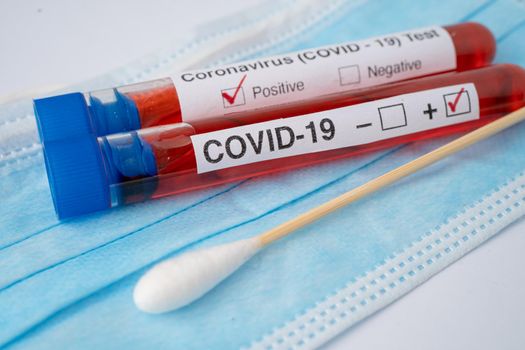 COVID-19 virus or Coronavirus sample blood test tube in laboratory of hospital.