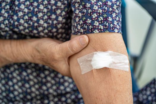 Asian senior or elderly old lady woman patient show cotton wool stop bleeding, after blood drawing testing for annually physical health check up to check cholesterol, blood pressure, and sugar level.