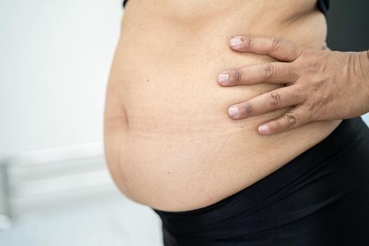 Overweight Asian woman show fat belly at office.