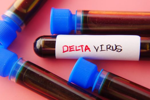 close up of delta corona virus blood test tube on blue background ,