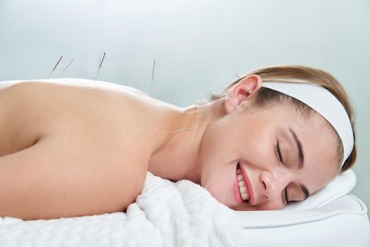 Doctor puts needles into female back on the acupuncture therapy in beauty salon. Alternative Medicine concept