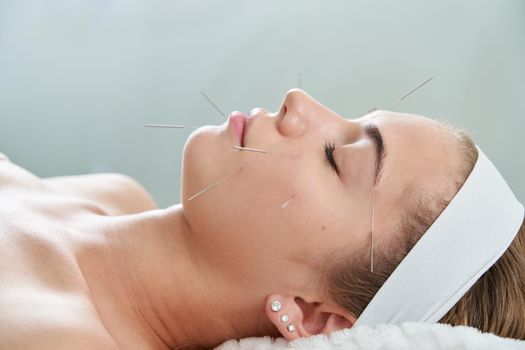 Young woman having an acupuncture treatment therapy on face in spa salon. Alternative medicine and therapy concept