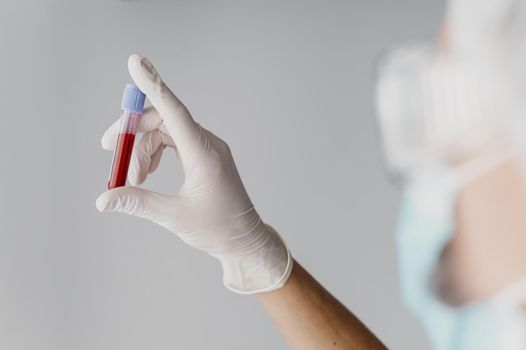 back view doctor holding blood sample. Resolution and high quality beautiful photo