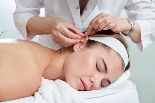 Beautiful young woman relaxing on a bed having acupuncture treatment with needles in and around her ear. Alternative Therapy concept