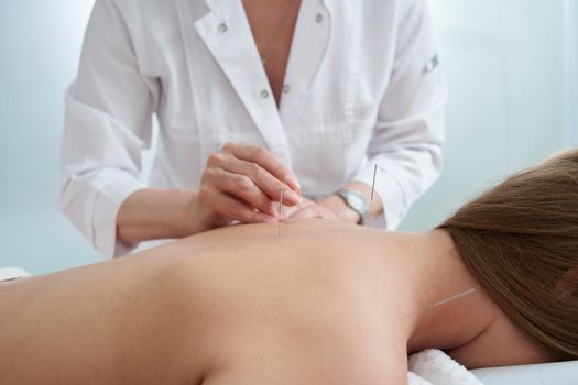 Doctor puts needles into female back on the acupuncture therapy in beauty salon. Alternative Medicine concept