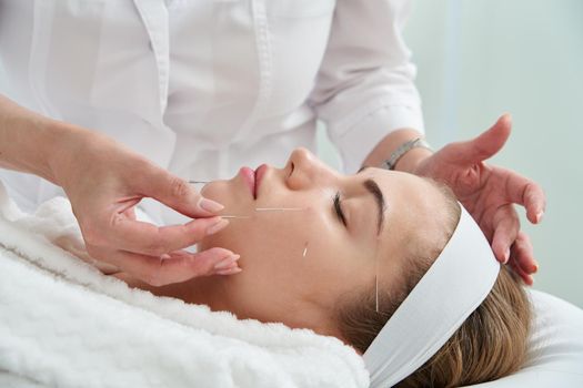 Young woman having an acupuncture treatment therapy on face in spa salon. Alternative medicine and therapy concept