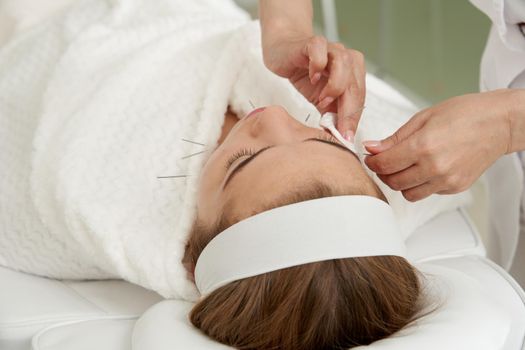 Doctor puts needles into female face on the acupuncture therapy in beauty salon. Alternative Medicine concept