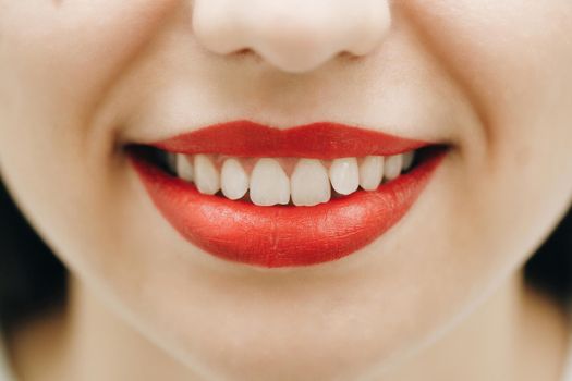 Smile after Teeth whitening procedure. Attractive woman smiling with beautiful healthy smile aesthetic dentistry. Professional dental cleaning, female patient's beautiful denture