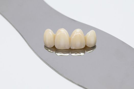 Metal free ceramic dental crowns.