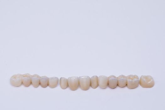 Beautiful dental bridge isolated on wite made of ceramic porcelain. Aesthetic restoration of tooth loss. Ceramic zirconium. Metal Free Ceramic Dental Crowns.