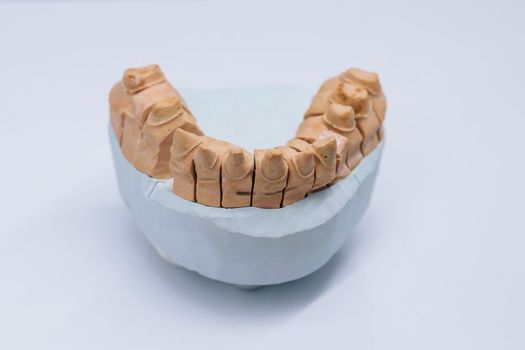 Dental molds on the table. Gypsum model plaster of tooth